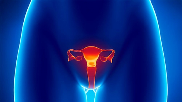 El tratamiento para el cáncer de ovario es posible y está cubierto por el Seguro Popular